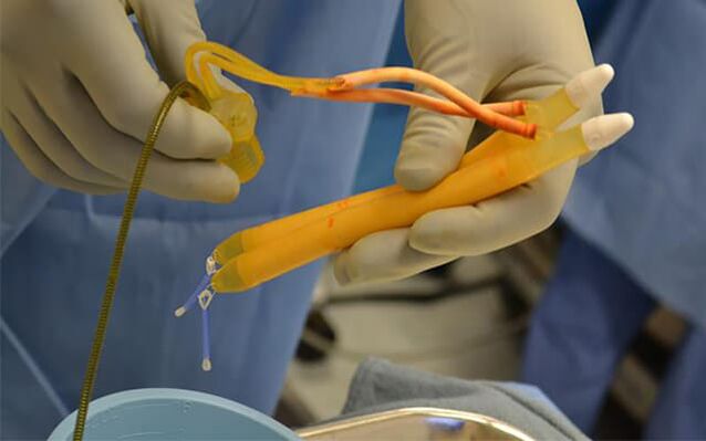 implants in penis