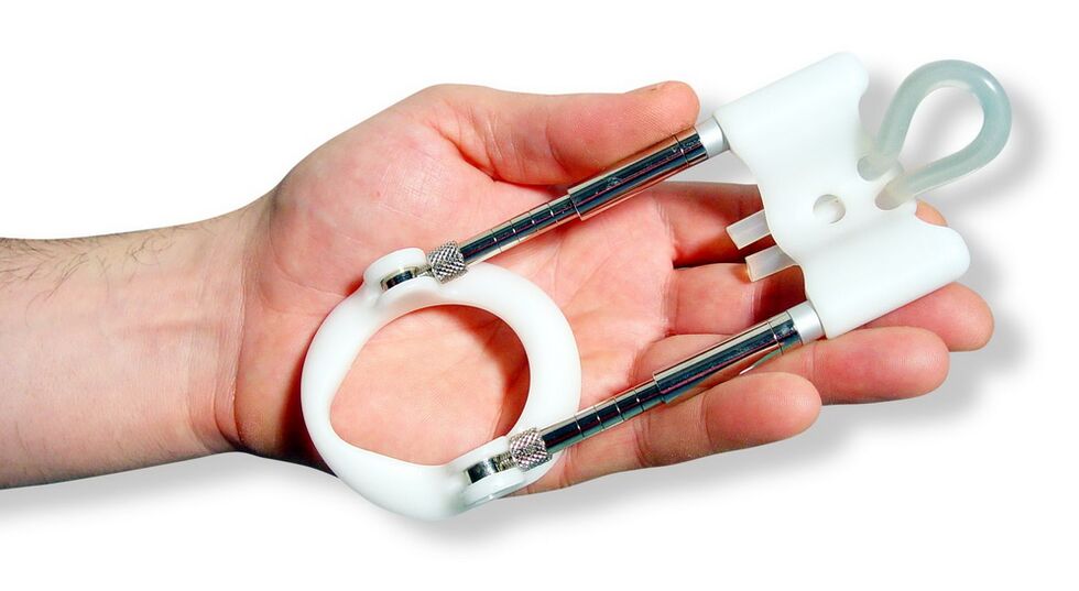 An extender is a device based on the principle of stretching penile tissue